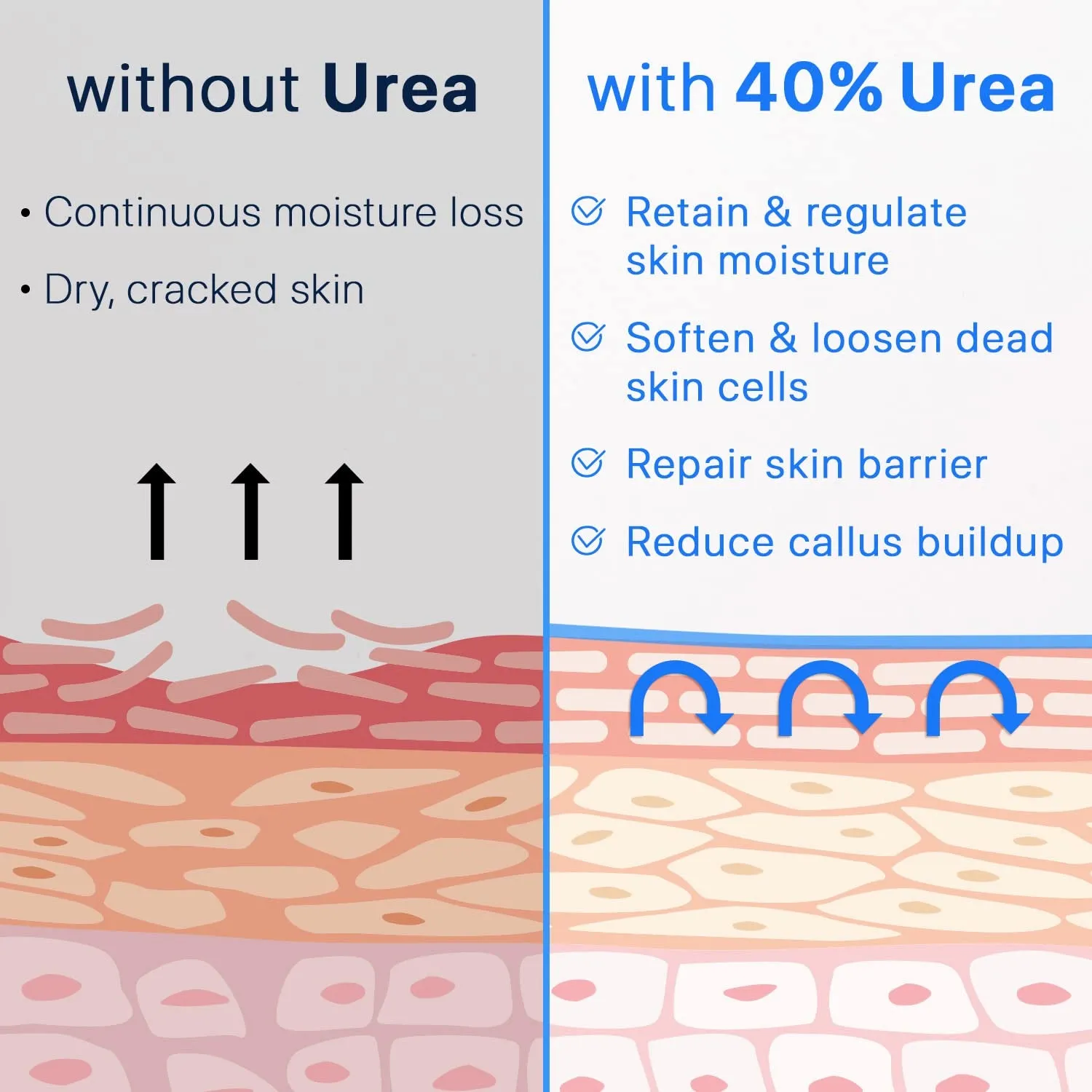 Urea Cream 40% plus Salicylic Acid 2%, Foot Cream for Dry Cracked Heels Feet Knees Elbows Hands, Foot Dead Skin Cuticle Callus Remover Toenail Softener, Keratolytic Skin Barrier Repair